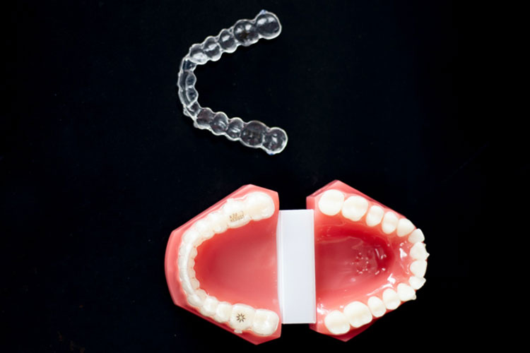 Invisalign