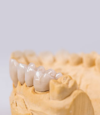 dental crown