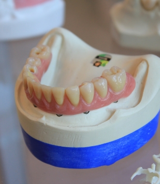 PARTIAL & COMPLETE DENTURES